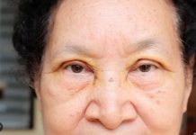 VOĆKA BROJ 1 PROTIV HOLESTEROLA, PRITISKA I MOŽDANOG UDARA: Ko je jede, zdrav je kao drijen!