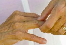 Ako ovo jedete, bol je jači, artritis napreduje, zglobovi se troše: KOSTI NE VOLE OVU HRANU