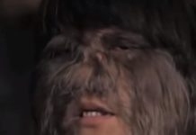 DEVOJKA SA LICEM MAJMUNA SE UDALA PA OBRIJALA LICE: Kada su je videli, ljudi se šokirali! Pogledajte kako SADA IZGLEDA