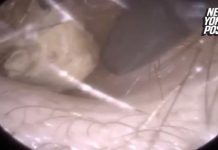 SVRBELO JE UVO DO BESVESTI, OTIŠLA U BOLNICU, A TAMO ŠOK: Kada su videli šta je unutra nisu mogli da veruju svojim očima! (FOTO)