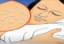 Pretjerano znojenje tijekom noći može ukazivati na prisutnost značajnih bolesti.