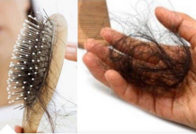 METODA KOJA U POTPUNOSTI DJELUJE: Evo kako zaustaviti opadanje kose