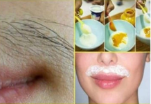 ZBOGOM DLAČICAMA: OVOM METODOM DLAČICE VIŠE NE RASTU