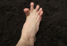 DA LI VAM SE GRČE PRSTI NA STOPALIMA? Evo Na Šta Vas To Upozorava, Može Biti Znak Većih Problema