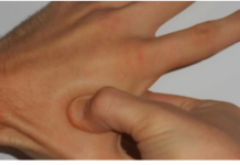 MASIRAJTE OVU TAČKU NA RUCI: Nestaje glavobolja, napetost u leđima, vratu i sinusima