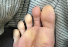 NOGE SU VAM LEDENE – STALNO HLADNE I NEMOGUĆE IH JE ZGRIJATI: Evo šta trebate uraditi