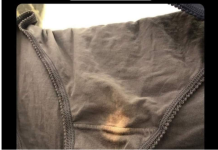 POJAVLJUJE VAM SE IZBIJELJENJE MRLJE NA DONJEM VEŠU – Evo šta to znači