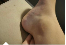 BOL U KIČMI I ZGLOBOVIMA JE ZAPRAVO BLOKADA KRVI I ENERGIJE: Čuveni Dr Bubnovski dao najjednostavniji način izlječenja!