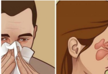 Budite se zapušenog nosa, a nije prehlada niti alergija? EVO ŠTA JE PROBLEM