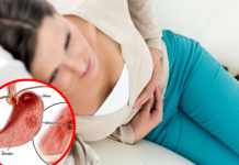 ‘Toliko me boli da ne mogu da spavam’: Doktori objašnjavaju koji simptomi ukazuju na čir na želucu