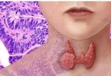 AKO IMATE PROBLEM SA ŠTITNOM ŽLIJEZDOM, OVE 2 NAMIRNICE IZBACITE: Štitna žlijezda ih nikako ne voli