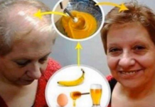 RECEPT ZA RAST VAŠE KOSE, DOKTORI CE ZANIJEMITI !