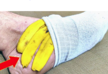 NIKADA NE BACAM KORU OD BANANE: Evo šta će se dogoditi ako je stavite na nogu