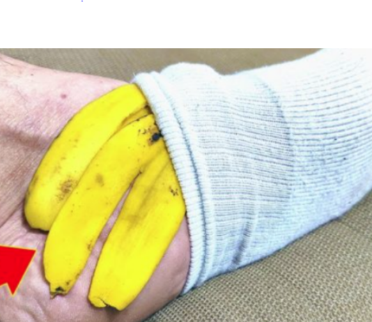 NIKADA NE BACAM KORU OD BANANE: Evo šta će se dogoditi ako je stavite na nogu