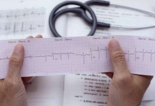 KOJA RUKA BOLI PRED INFARKT: Srčani udar najavljuje ovaj rani simptom, spriječite to