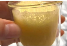 OVA SMJESA JE EFIKASNIJA OD SVAKOG ANTIBIOTIKA, SAM0 PET KAPI I POBIJEDIT ĆETE I NAJJAČU INFEKCIJU: Sastojke Sigurno Imate Kod Kuće