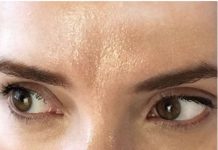 MASNO ČELO, BUBULJICE, GRUBI OBRAZI: Šta nam to koža PORUČUJE? OBAVEZNO POGLEDAJTE