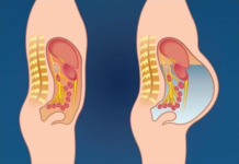 OVO POVRĆE IZAZIVA NADIMANJE STOMAKA I GASOVE: Ovu hranu izbjegavajte ako želite ravan stomak