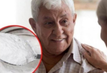 SODA BIKARBONA ZA HEMOROIDE: Mogu da se povuku sami, važno je da uradite 2 stvari