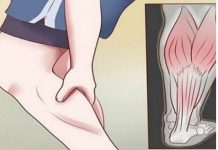 GRČEVI U NOGAMA SU OPASAN SIMPTOM: Evo na šta ukazuje bol u listovima i butinama!