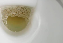 Vidite li mjehuriće u urinu? To može ukazivati na ozbiljnije zdravstveno stanje!