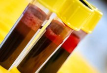 BOMBA ZA KRVNU SLIKU: Tri kašike dnevno, napravite ovu smjesu sami kod kuće