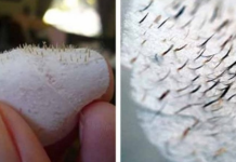 MITESERI SAMI ISPADAJU IZ PORA: Uz ova DVA sastojka koja već imate u kući OČISTITE LICE DO SAVRŠENSTVA!