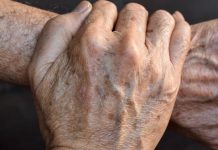 PERŠIN Zauvijek Uklanja STARAČKE MRLJE! Ovo Morate Napraviti…