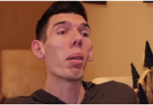 Dalibor iz Zrenjanina je najviši čovek u Srbiji, svi su u čudu kad čuju koji broj cipela nosi: Na šok način ulazi u kuću