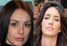 ESTETSKI HIRURG RASKRINKAO SLOBODU MIĆALOVIĆ I JELISAVETU ORAŠANIN: Otkrio spisak operacija – evo sta su sve radile