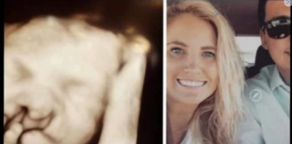 Doktori su mi rekli “abortus” kad su vidjeli bebin ultrazvuk: Nismo ih poslušali Moj sin danas ima 6 godina i izgleda ovako