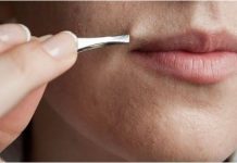 DOSADILO VAM JE DA ČUPATE DLAKE- UKLONITE IH ZAUVIJEK SA 5 MINUTA MASAŽE OVE SMJESOM..(FOTO)