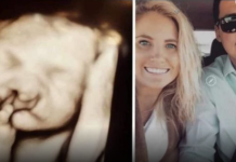 Doktori su mi rekli “abortus” kad su vidjeli bebin ultrazvuk: Nismo ih poslušali Moj sin danas ima 6 godina i izgleda ovako