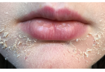 Signali KOJE VAM TIJELO ŠALJE : Šta Znače Promjene na Koži i Kosi?