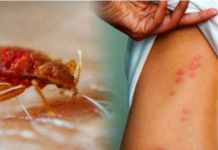 Ovo su znakovi da u kući imate stjenice: EVO KAKO DA IH SE MOMENTALNO RIJEŠITE