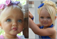 Bila je najljepša beba na svijetu, majka se na njoj obogatila: Sada niko ne vjeruje kako izgleda