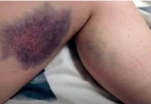 Vitamini koje je zabranjeno uzimati zajedno, ALI NIKO NE ZNA, MOGU BITI OPASNI