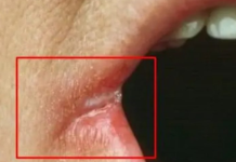 OPASNO PO ŽIVOT: Imate li neki od OVIH simptoma? Nagovještavaju nešto loše!