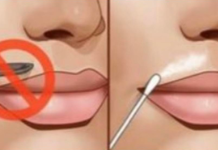 TAKO ĆETE LICE P0TPUNO BEZB0LNO RIJEŠITI RUŽNIH DLAČICA: Nećete potrošiti ni eura, a sve što vam treba već imate kod kuće