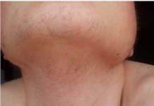 EVO ZAŠTO ŽENE IMAJU DLAKAVU BRADU! Ovo vam organizam govori!