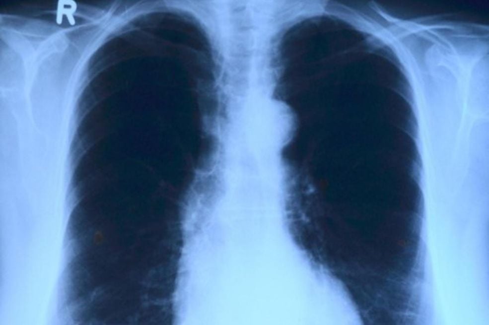 1760460896-e74215e064bdd92deba5-690x480