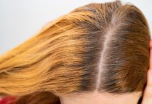 Kako prekriti izrastak bez farbanja? 6 superbrzih trikova koji uvek deluju