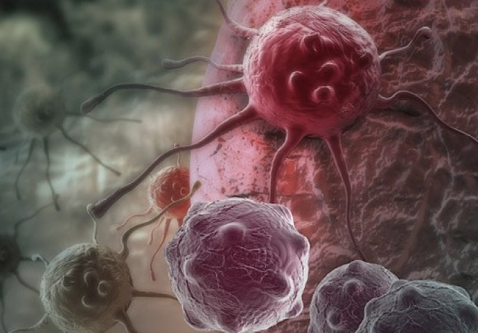 5c0700ca-fbc4-4169-822e-0e250a0a0a67-kancer-640x360-690x480