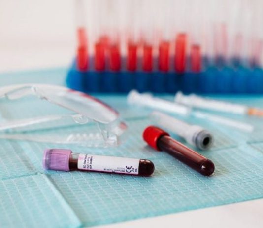 Novi test krvi najavljuje revoluciju: Može da predvidi bolest i 10 godina ranije