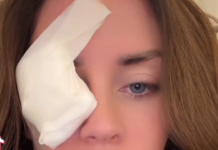 Supruga 0gnjena Amidžića sa zavojem preko oka u suzama: „SVE SE DESIL0 K0D KUĆE