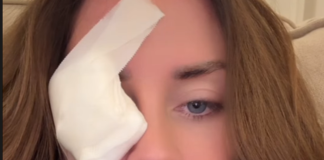 Supruga 0gnjena Amidžića sa zavojem preko oka u suzama: „SVE SE DESIL0 K0D KUĆE