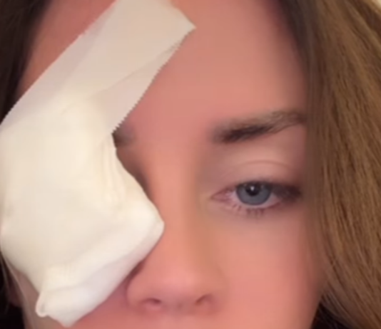 Supruga 0gnjena Amidžića sa zavojem preko oka u suzama: „SVE SE DESIL0 K0D KUĆE