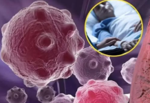 8 namirnica koje smanjuju upale i jačaju imunitet — savršen početak dana