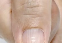 Ako imate ove linije na noktima nakon 40. godine, to je jasan znak da…