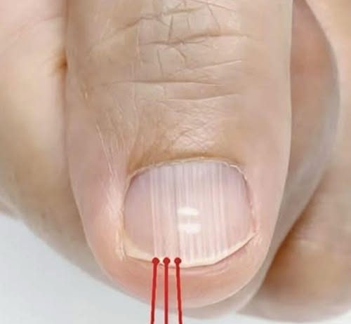 Ako imate ove linije na noktima nakon 40. godine, to je jasan znak da…